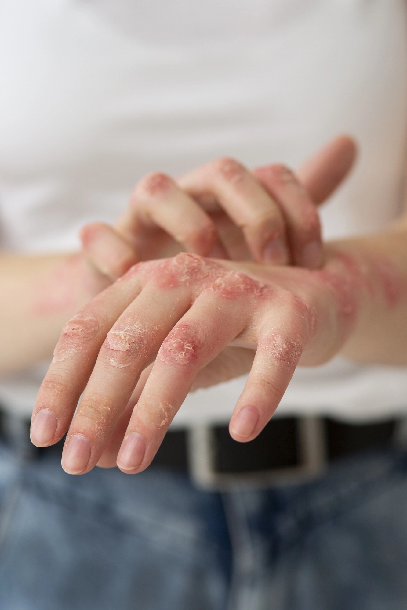 Dermatológico