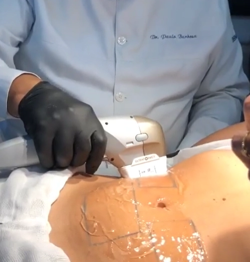Tecnologias Laser